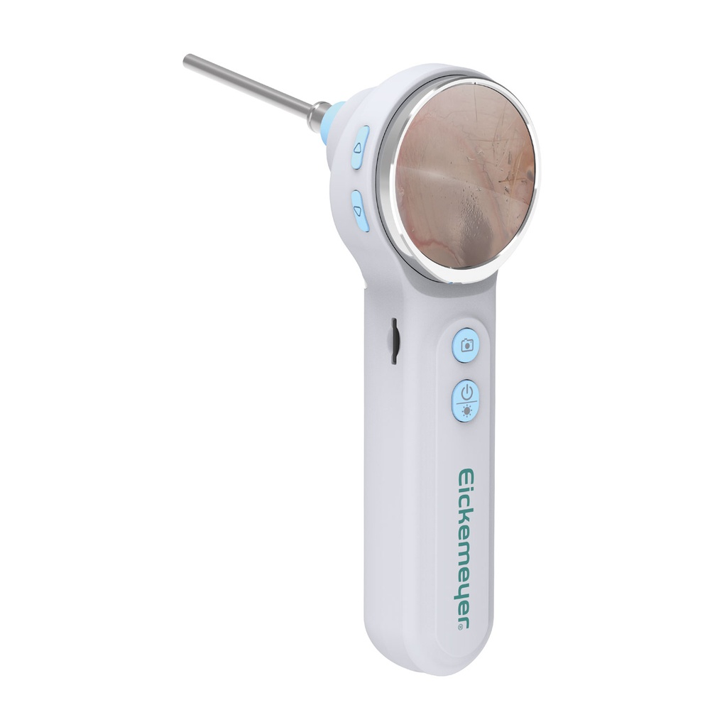 EickView OTO – digitalt video otoskop1